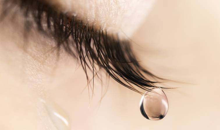 watery eye, due to the effect of dry eye condition