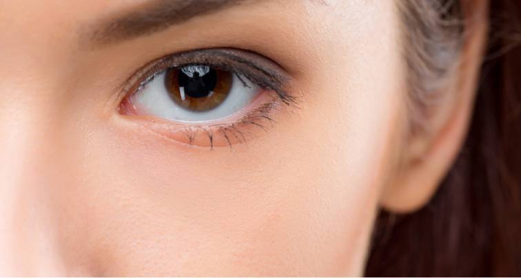 Should You Worry about Dry Eyes or Eye Strain with Contact Lenses?